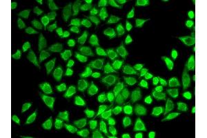 Immunofluorescence analysis of HeLa cell using IL7R antibody. (IL7R Antikörper  (AA 21-239))