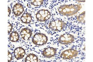Immunohistochemistry analysis of paraffin-embedded human colon using Claudin 5 Polyclonal Antibody at dilution of 1:400.