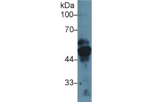 Western Blot; Sample: Human MCF7 cell lysate; Primary Ab: 1µg/ml Rabbit Anti-Rat KRT17 Antibody Second Ab: 0. (KRT17 Antikörper  (AA 84-392))
