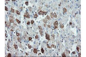 Immunohistochemical staining of paraffin-embedded Human liver tissue using anti-SDCBP mouse monoclonal antibody. (SDCBP Antikörper)