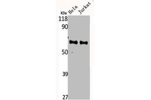 Western Blot analysis of HELA Jurkat cells using CYP4F2 Polyclonal Antibody (CYP4F2 Antikörper  (N-Term))