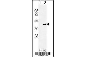 Western blot analysis of OGN using rabbit polyclonal OGN Antibody using 293 cell lysates (2 ug/lane) either nontransfected (Lane 1) or transiently transfected (Lane 2) with the OGN gene. (OGN Antikörper  (C-Term))