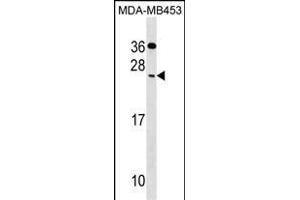 CIDEC Antibody (Center) (ABIN1538717 and ABIN2849747) western blot analysis in MDA-M cell line lysates (35 μg/lane).