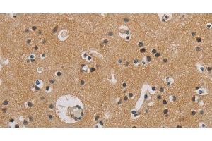 Immunohistochemistry of paraffin-embedded Human brain tissue using ITGB3BP Polyclonal Antibody at dilution 1:50 (ITGB3BP Antikörper)