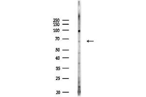 anti-RAS Guanyl Releasing Protein 2 (Calcium and DAG-Regulated) (RASGRP2) antibody