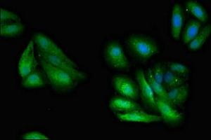 Immunofluorescence (IF) image for anti-Guanine Nucleotide Binding Protein (G Protein), beta Polypeptide 1 (GNB1) (AA 157-248) antibody (ABIN7154688)