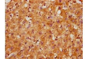 IHC image of ABIN7148116 diluted at 1:200 and staining in paraffin-embedded human liver tissue performed on a Leica BondTM system.