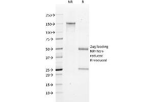 SDS-PAGE Analysis Purified Bax Mouse Monoclonal Antibody (2D2). (BAX Antikörper  (AA 3-16))