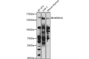 Western blot analysis of extracts of various cell lines, using KDM4A antibody (ABIN6131821, ABIN6142793, ABIN6142795 and ABIN6223960) at 1:1000 dilution. (KDM4A Antikörper  (AA 585-815))