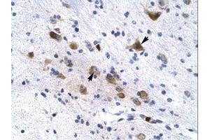 Image no. 1 for anti-Potassium Voltage-Gated Channel, Subfamily H (Eag-Related), Member 6 (KCNH6) (AA 173-222) antibody (ABIN202961) (KCNH6 Antikörper  (AA 173-222))