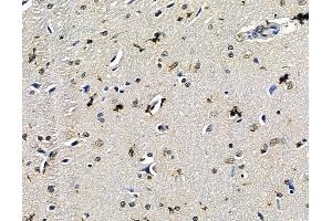 ABIN7096723 and ABIN7100788 at 1/100 staining rat brain tissue by IHC-P. (EXOSC6 Antikörper)
