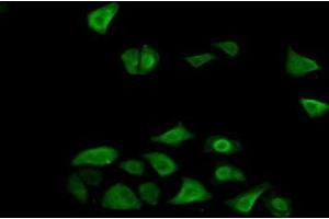Detection of FN3K in Human Hela Cells using Polyclonal Antibody to Fructosamine-3-Kinase (FN3K) (FN3K Antikörper  (AA 1-309))
