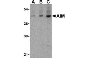 Image no. 1 for anti-CD5 Molecule-Like (CD5L) (N-Term) antibody (ABIN318737) (CD5L Antikörper  (N-Term))