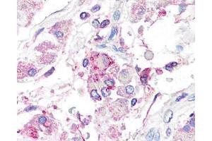 Image no. 3 for anti-Cytochrome P450, Family 19, Subfamily A, Polypeptide 1 (CYP19A1) antibody (ABIN126953) (Aromatase Antikörper)