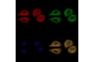 ABIN6259994 and ABIN6276620 staining Hela cells by IF/ICC.