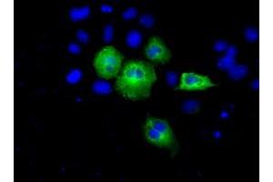 Image no. 2 for anti-Acetyl-CoA Acetyltransferase 2 (ACAT2) antibody (ABIN1496403) (ACAT2 Antikörper)