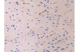 Immunohistochemistry (IHC) image for anti-Fibulin 4 (FBLN4) (AA 182-431) antibody (ABIN7437848)