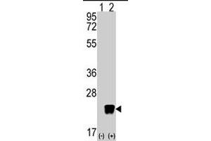 Western blot analysis of ARL3 (arrow) using rabbit ARL3 polyclonal antibody . (ARL3 Antikörper  (C-Term))
