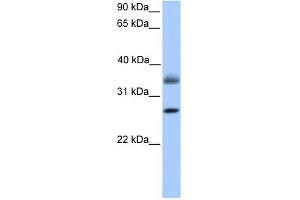 LGALS8 antibody used at 1 ug/ml to detect target protein. (LGALS8 Antikörper)