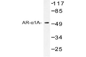 Image no. 1 for anti-Adrenoceptor alpha 1A (ADRA1A) antibody (ABIN272286) (alpha 1 Adrenergic Receptor Antikörper)