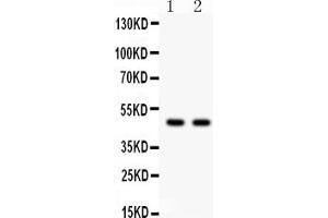 anti-Prostate Tumor Overexpressed 1 (PTOV1) (AA 385-414), (C-Term) antibody