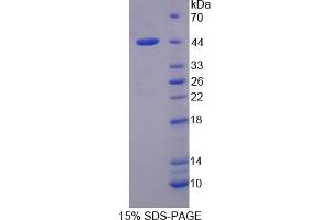 Image no. 1 for Calpain 10 (CAPN10) (AA 22-374) protein (His tag) (ABIN6237397) (CAPN10 Protein (AA 22-374) (His tag))