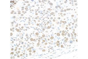 Immunohistochemistry (IHC) image for anti-RNA-binding protein Raly (RALY) (AA 256-306) antibody (ABIN7454547) (Raly Antikörper  (AA 256-306))