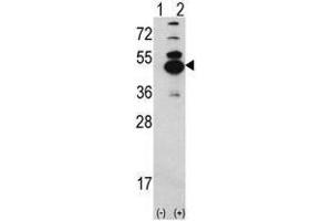 Image no. 1 for anti-Calcium/calmodulin-Dependent Protein Kinase ID (CAMK1D) (N-Term) antibody (ABIN452804) (CAMK1D Antikörper  (N-Term))