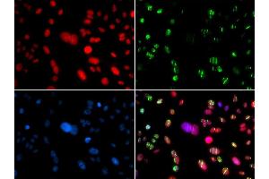 Immunofluorescence analysis of GFP-RNF168 transgenic U2OS cells using RAG2 antibody. (RAG2 Antikörper  (AA 258-527))