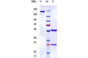 Anti-SIRPg / CD172g Reference Antibody (KWAR23) on SDS-PAGE under reducing (R) condition. (Rekombinanter SIRPG Antikörper)
