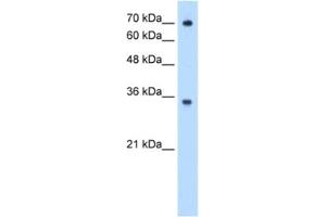 Western Blotting (WB) image for anti-IgG receptor FcRn (FcRn) antibody (ABIN2462979) (FcRn Antikörper)