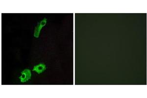 Immunofluorescence analysis of HeLa cells, using GPR151 antibody. (GPR151 Antikörper  (C-Term))