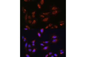 Immunofluorescence analysis of U-2 OS cells using RALGDS antibody (ABIN7269838) at dilution of 1:100. (RALGDS Antikörper)