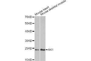 Western blot analysis of extracts of various cell lines, using AK1 antibody. (Adenylate Kinase 1 Antikörper)