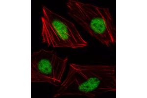 Immunofluorescence (IF) image for anti-T-Box 15 (TBX15) antibody (ABIN3000287) (T-Box 15 Antikörper)