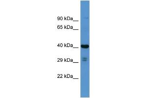 Host: Rabbit Target Name: SCAMP3 Sample Type: RPMI-8226 Whole cell lysates Antibody Dilution: 1. (SCAMP3 Antikörper  (N-Term))