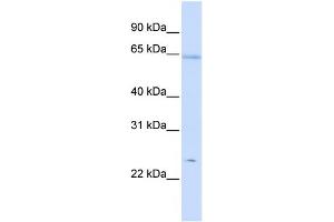 WB Suggested Anti-PRDX2 Antibody Titration:  0. (Peroxiredoxin 2 Antikörper  (Middle Region))