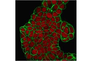 Immunofluorescent staining of PFA-fixed MCF-7 cells. (CD47 Antikörper)