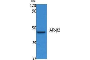 Western Blotting (WB) image for anti-Androgen Receptor beta 2 (Ser127) antibody (ABIN3187616) (Androgen Receptor beta 2 Antikörper  (Ser127))