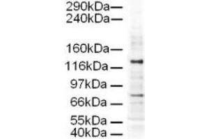 Image no. 1 for anti-Adaptor-Related Protein Complex 3, delta 1 Subunit (AP3D1) (AA 686-698) antibody (ABIN401171) (AP3D1 Antikörper  (AA 686-698))