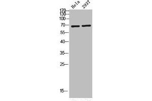 Western Blot analysis of HELA 293T cells using Phospho-PKC ζ (T560) Polyclonal Antibody (PKC zeta Antikörper  (pThr560))