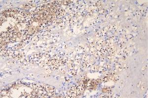IHC analysis of FHL using anti-FHL antibody (ABIN7600488).