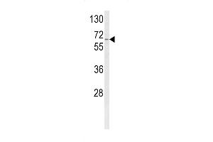 CYP4F3 Antikörper  (N-Term)