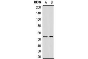 Western blot analysis of Annexin A7 expression in A549 (A), NS-1 (B) whole cell lysates.
