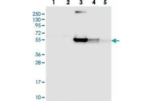 Western blot analysis of Lane 1: RT-4, Lane 2: U-251 MG, Lane 3: Human Plasma, Lane 4: Liver, Lane 5: Tonsil with RINL polyclonal antibody . (RINL Antikörper)