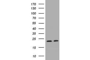 Image no. 1 for anti-GTPase Kras (KRAS) antibody (ABIN1499069) (K-RAS Antikörper)