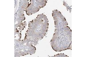 Immunohistochemical staining of human fallopian tube with LBA1 polyclonal antibody  shows distinct positivity in cilia of glandular cells. (LBA1 Antikörper)