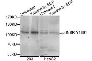 Western Blotting (WB) image for anti-Insulin Receptor beta (ISR-beta) (pTyr1361), (Tyr1361) antibody (ABIN2987226)