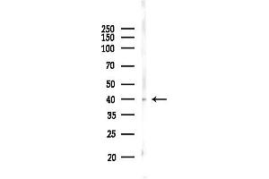Western blot analysis of lysates from PC12 cells, using Phospho-IKB beta (Ser23) Antibody at 1/1000 dilution.
