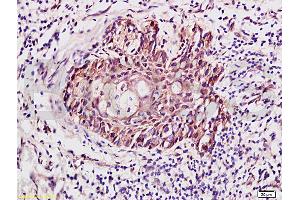 Formalin-fixed and paraffin embedded human skin labeled with Anti-RhoA Polyclonal Antibody (ABIN738846), Unconjugated 1:400 followed by conjugation to the secondary antibody and DAB staining (RhoA/ C (AA 101-193) Antikörper)